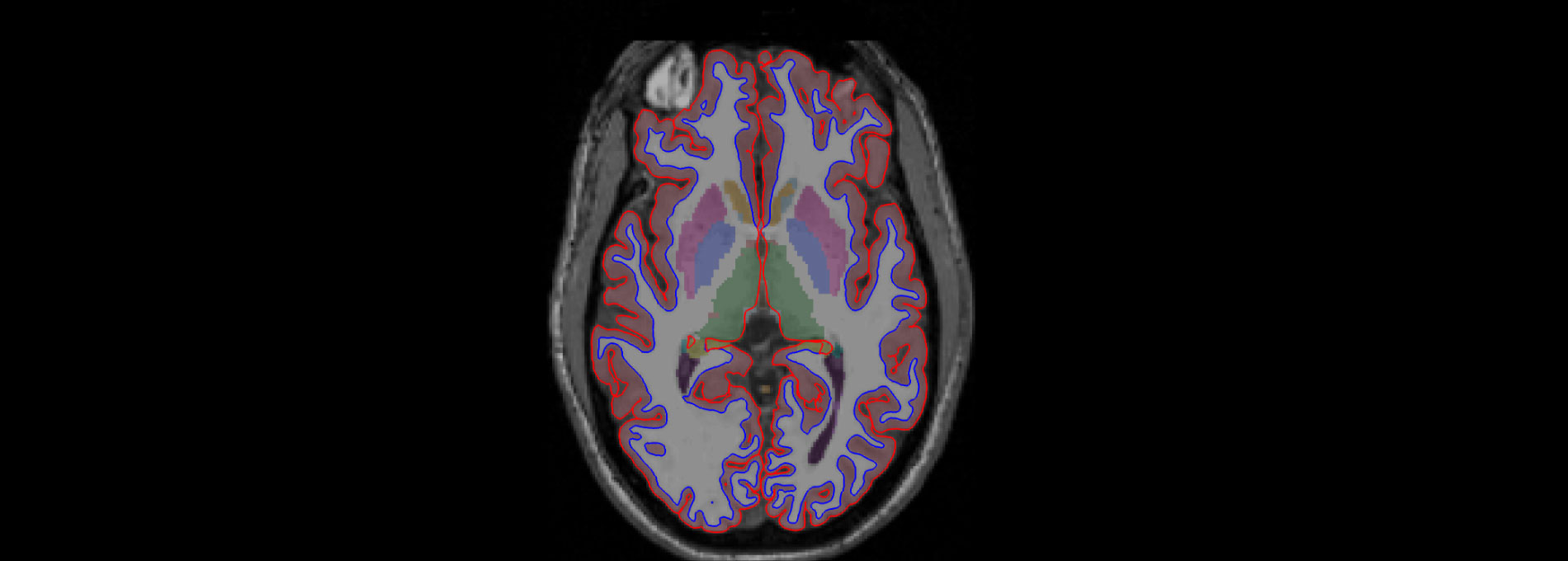 CNS brain scan