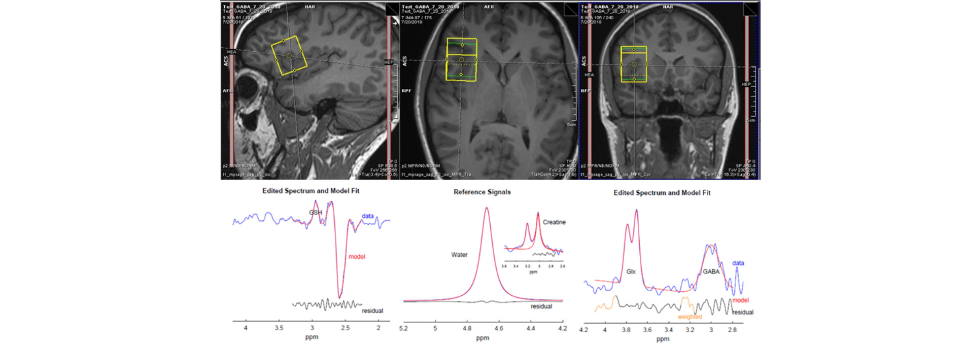 Scans of brain