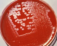 Photo of anthrax in dish