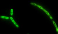 Photo of anthrax spores