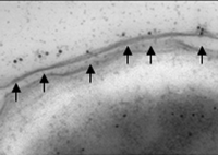 Photo of anthrax proteins