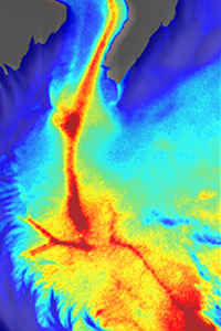Moor FLPI-2 laser speckle contrast image of blood flow