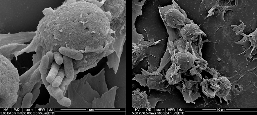 SEM of a Dropsophilia macrophage infected with Y. pestis