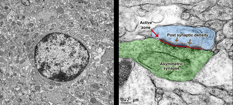 Resin embedded TEM of blast induced traumatic brain injury; colored illustration highlights nerve cell junctions in mouse cortex. 