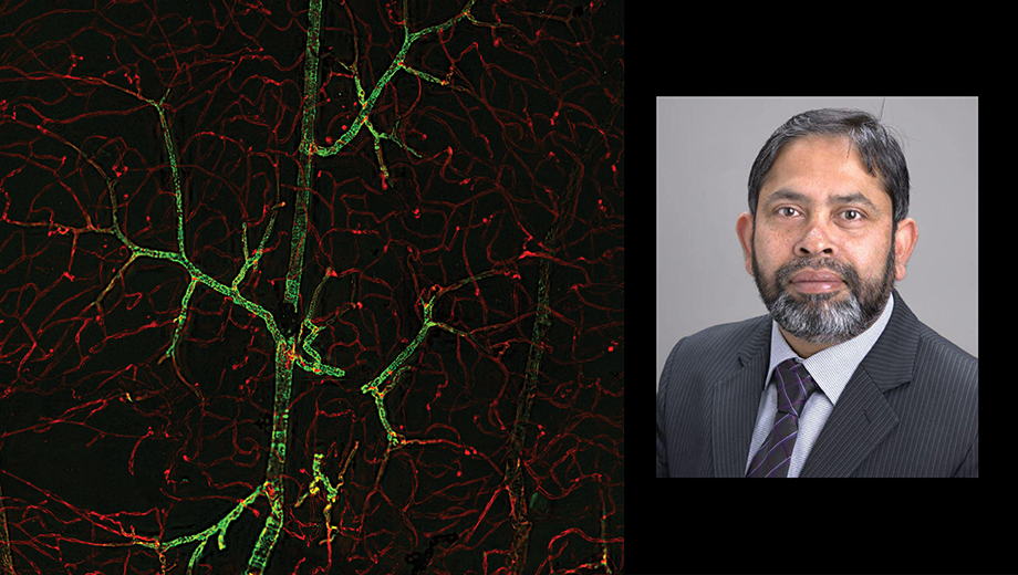 “Seeing” Blood Vessels art with photo of Fazle Elahi