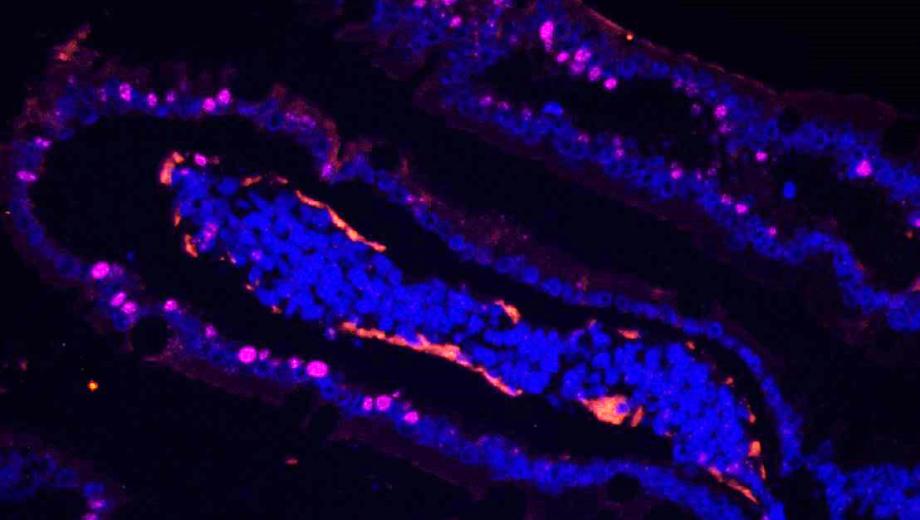 Image of tissue infect with the COVID-19 virus