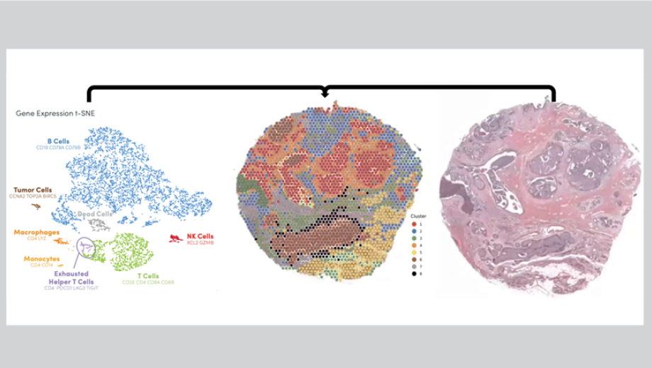 Art created with 10X Genomics Visium technology of tissue to connect biological process with architecture.