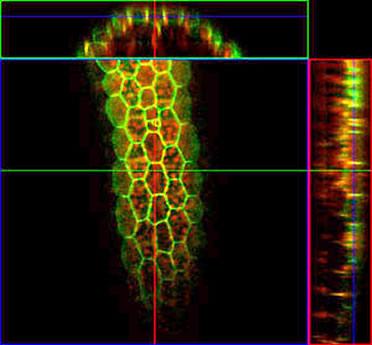 3-D and orthogonal plane analysis using Imaris Slice Module.