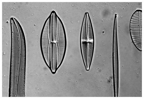 Diatomes imaged using DIC (Differential Interference Contrast) for enhanced details