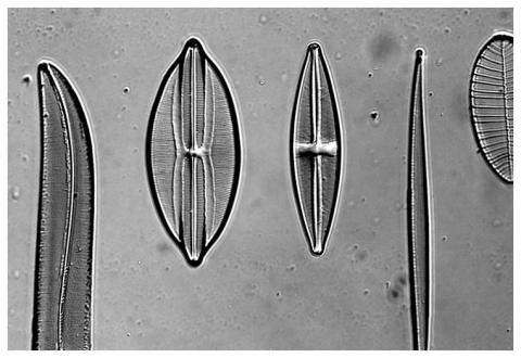 Diatomes imaged using DIC