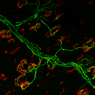 2013 winner, Madeline Miller, Christian Lorson's lab