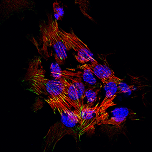 2017 winner, Vinit Shanbhag, Michael Petris' lab