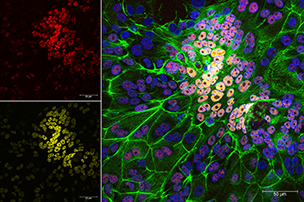 Teka Khan, Michael Roberts’ lab winning image