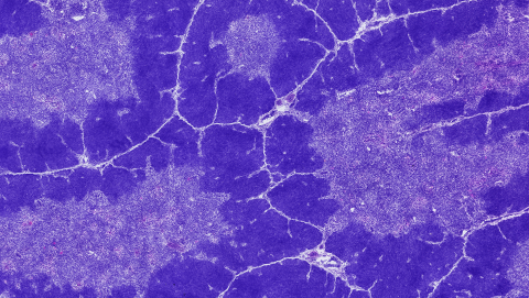 Microscopic image of chicken thymus