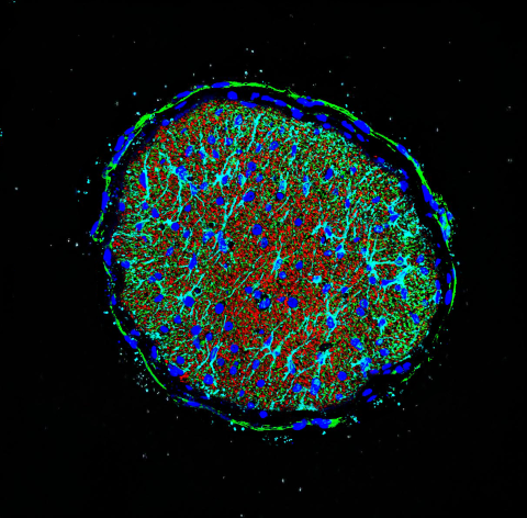 Microscopic image of mouse optic nerve