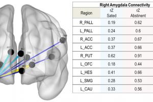 Brain