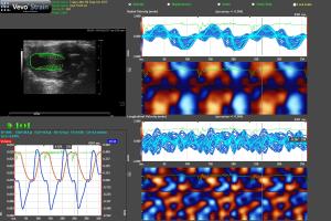 Visualsonics Vevo 2100 output