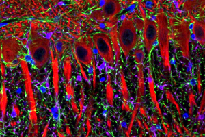 A thin slice of frozen brain tissue from the hippocampus of a cloned pig