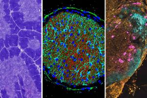 Composite image of microscopic images of a section of chicken thymus, a cross-section of a mouse optic nerve and a slice of a mouse ovarian tumor.